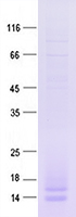 Purified recombinant protein C2orf66 was analyzed by SDS-PAGE gel and Coomossie Blue Staining.