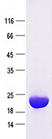 Purified recombinant protein IL6 was analyzed by SDS-PAGE gel and Coomossie Blue Staining.