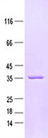 Purified recombinant protein PCNA was analyzed by SDS-PAGE gel and Coomossie Blue Staining.