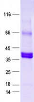 Purified recombinant protein CCN1 was analyzed by SDS-PAGE gel and Coomossie Blue Staining.