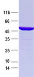 SARS-CoV-2 N蛋白