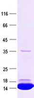 Purified recombinant protein NSP3 was analyzed by SDS-PAGE gel and Coomossie Blue Staining.