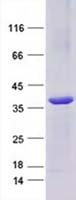 Purified recombinant protein Marc1 was analyzed by SDS-PAGE gel and Coomossie Blue Staining.
