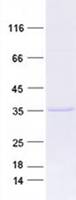 Purified recombinant protein APOE was analyzed by SDS-PAGE gel and Coomossie Blue Staining.