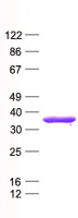 TP53TG5 (NM_014477) Human Recombinant Protein