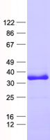 OFCC1 (NM_153003) Human Recombinant Protein