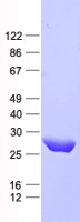PNPLA4 (NM_001142389) Human Recombinant Protein