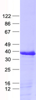 FBXO17 (NM_024907) Human Recombinant Protein