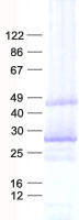 MAB21L1 (NM_005584) Human Recombinant Protein