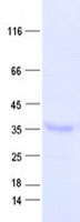 DUS4L (NM_181581) Human Recombinant Protein