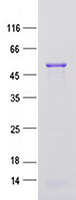 KIAA1712 (CEP44) (NM_001145314) Human Recombinant Protein