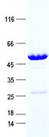 SERTAD3 (NM_013368) Human Recombinant Protein