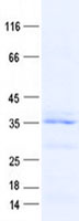 DEPDC4 (NM_152317) Human Recombinant Protein