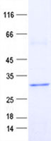 ETFBKMT (NM_001135863) Human Recombinant Protein
