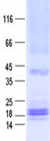 Malignant T cell amplified sequence 1 (MCTS1) (NM_014060) Human Recombinant Protein