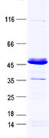 GCAP3 (GUCA1C) (NM_005459) Human Recombinant Protein