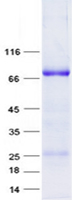 KRT86 (NM_002284) Human Recombinant Protein