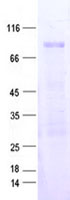 ZNF548 (NM_152909) Human Recombinant Protein