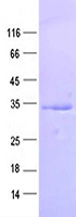 Purified recombinant protein RGMB was analyzed by SDS-PAGE gel and Coomossie Blue Staining.