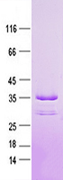 Purified recombinant protein SYNM was analyzed by SDS-PAGE gel and Coomossie Blue Staining.