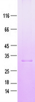 Purified recombinant protein CCNT2 was analyzed by SDS-PAGE gel and Coomossie Blue Staining.
