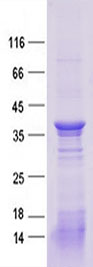 Purified recombinant protein TBX15 was analyzed by SDS-PAGE gel and Coomossie Blue Staining.