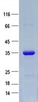 Purified recombinant protein FBXO11 was analyzed by SDS-PAGE gel and Coomossie Blue Staining.