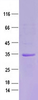 Purified recombinant protein NLRP5 was analyzed by SDS-PAGE gel and Coomossie Blue Staining.