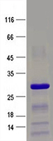 Purified recombinant protein RNF40 was analyzed by SDS-PAGE gel and Coomossie Blue Staining.