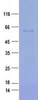 Purified recombinant protein USP17L2 was analyzed by SDS-PAGE gel and Coomossie Blue Staining.