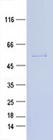 Coomassie blue staining of purified MFAP3L protein (Cat #TP762518). The protein was produced from E.coli.