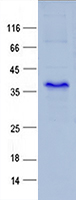 Purified recombinant protein KRTAP12 was analyzed by SDS-PAGE gel and Coomossie Blue Staining.