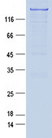 Purified recombinant protein PASD1 was analyzed by SDS-PAGE gel and Coomossie Blue Staining.