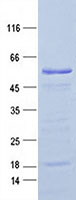 Purified recombinant protein TSGA13 was analyzed by SDS-PAGE gel and Coomossie Blue Staining.