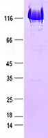 Purified recombinant protein Dead Cas9 was analyzed by SDS-PAGE gel and Coomossie Blue Staining.
