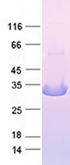 Purified recombinant protein Nuclease was analyzed by SDS-PAGE gel and Coomossie Blue Staining.