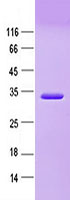 Purified recombinant protein BirA was analyzed by SDS-PAGE gel and Coomossie Blue Staining.