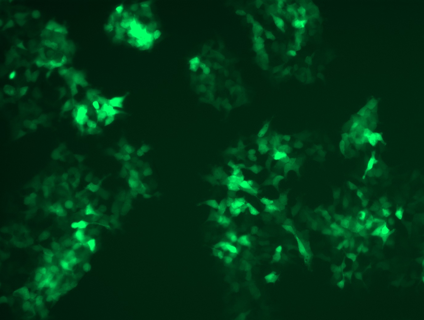 GFP signal was observed under microscope at 48 hours after transduction of TL303133A virus into HEK293 cells. TL303133A virus was prepared using lenti-shRNA TL303133A and TR30037 packaging kit.