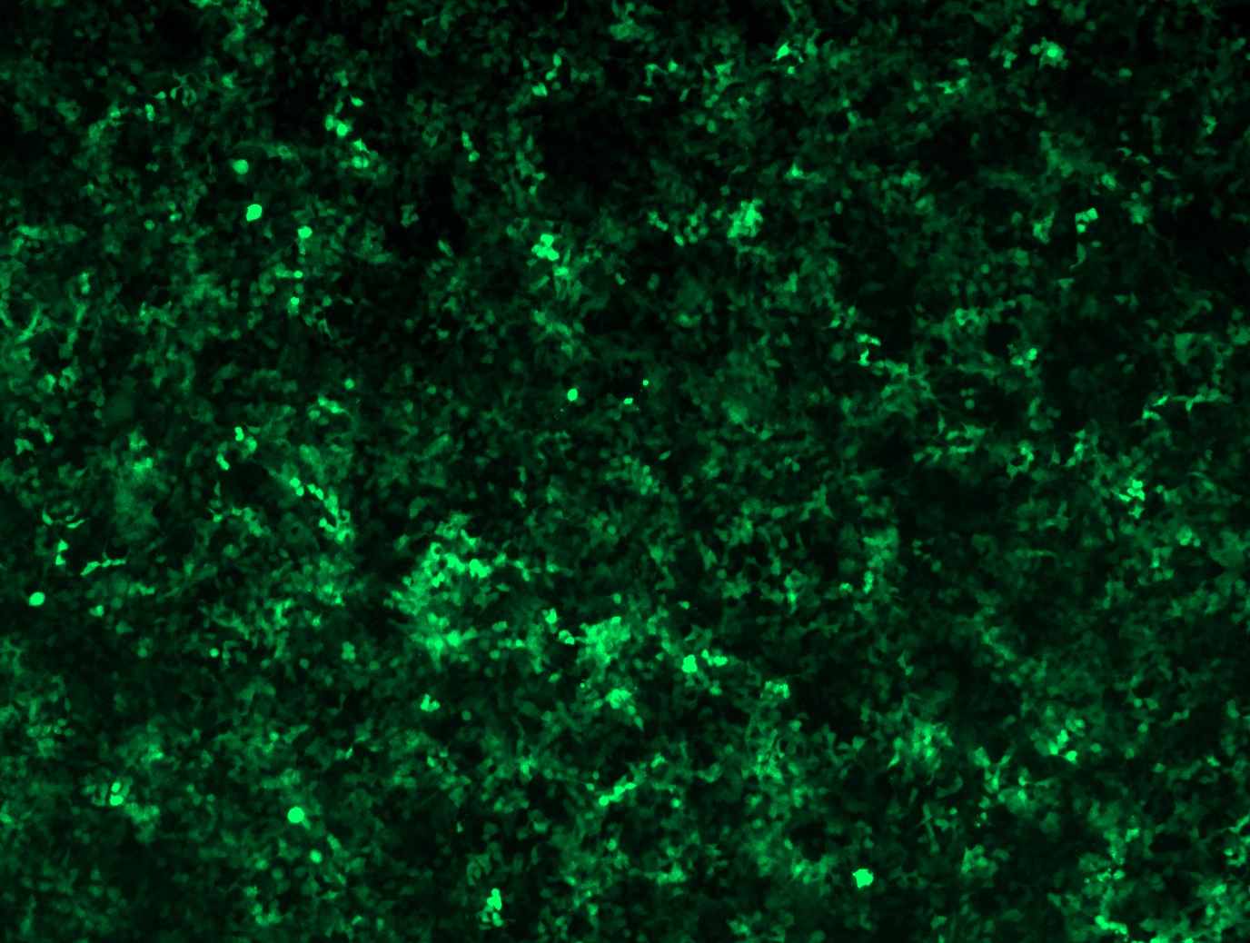 GFP signal was observed under microscope at 48 hours after transduction of TL304247A virus into HEK293 cells. TL304247A virus was prepared using lenti-shRNA TL304247A and TR30037 packaging kit.