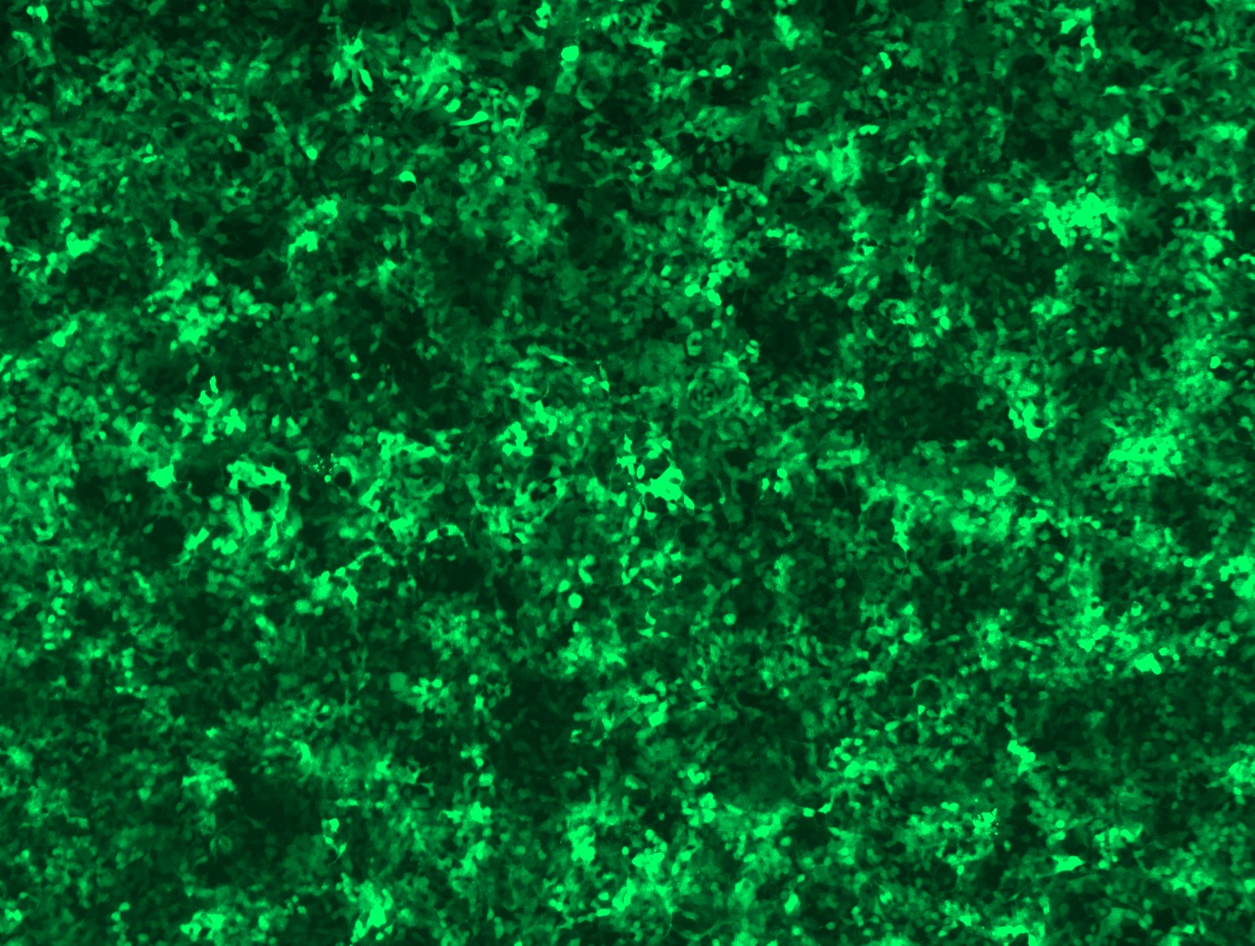 GFP signal was observed under microscope at 48 hours after transduction of TL304835A virus into HEK293 cells. TL304835A virus was prepared using lenti-shRNA TL304835A and TR30037 packaging kit.