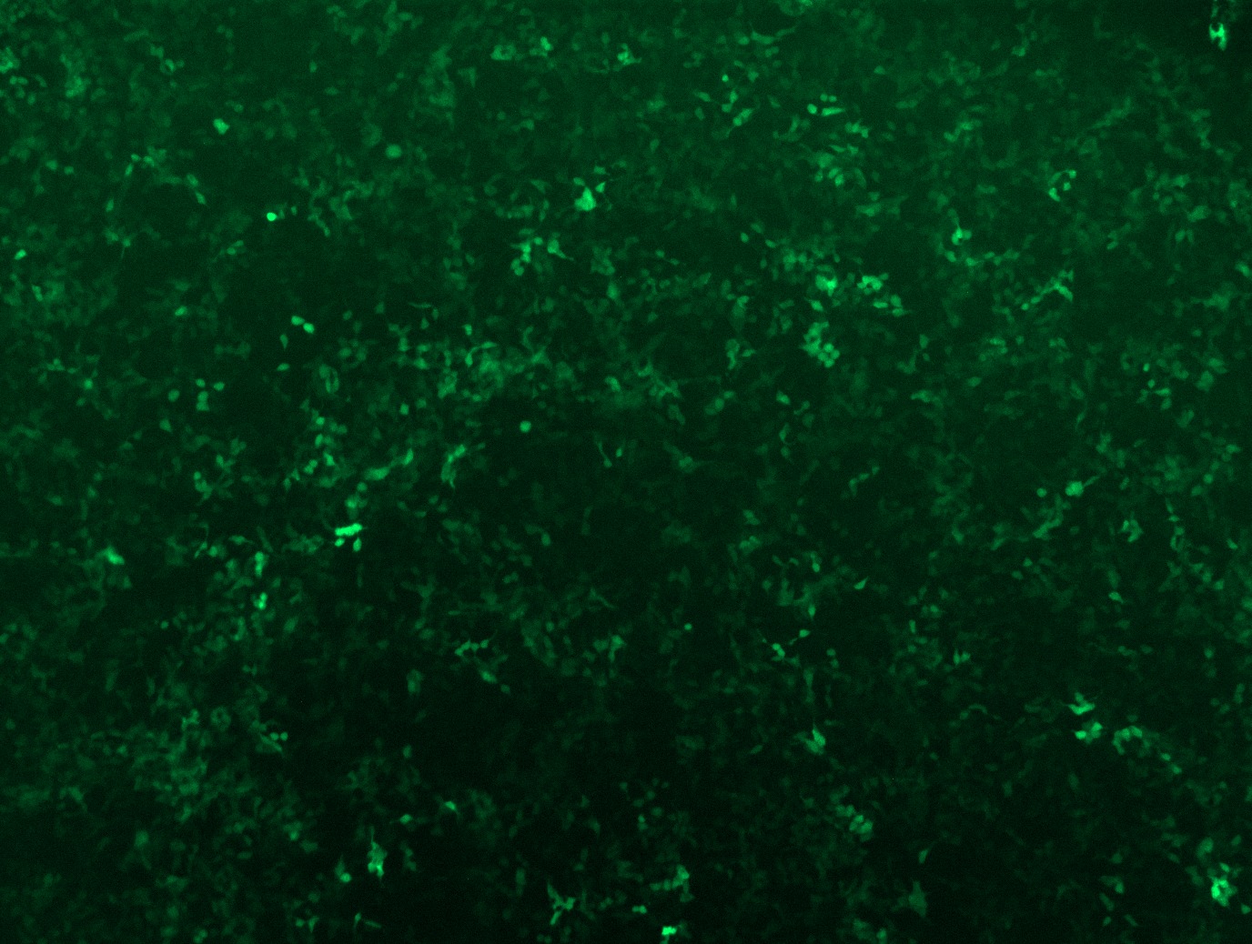 GFP signal was observed under microscope at 48 hours after transduction of TL305993A virus into HEK293 cells. TL305993A virus was prepared using lenti-shRNA TL305993A and TR30037 packaging kit.