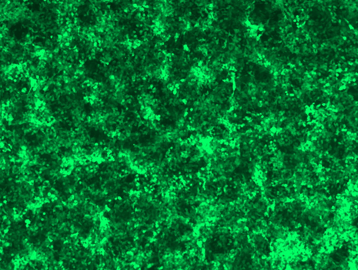 GFP signal was observed under microscope at 48 hours after transduction of TL306029A virus into HEK293 cells. TL306029A virus was prepared using lenti-shRNA TL306029A and TR30037 packaging kit.