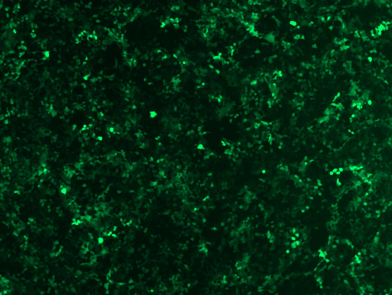 GFP signal was observed under microscope at 48 hours after transduction of TL306767A virus into HEK293 cells. TL306767A virus was prepared using lenti-shRNA TL306767A and TR30037 packaging kit.