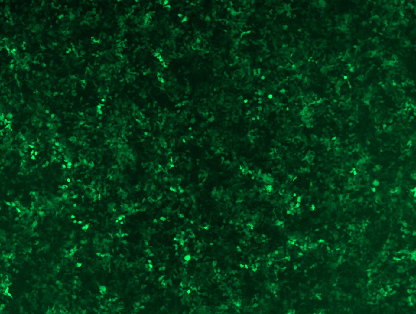 GFP signal was observed under microscope at 48 hours after transduction of TL307748A virus into HEK293 cells. TL307748A virus was prepared using lenti-shRNA TL307748A and TR30037 packaging kit.