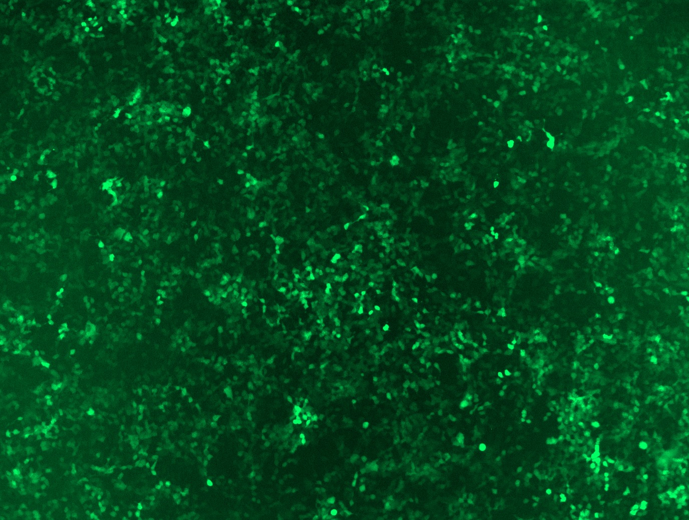 GFP signal was observed under microscope at 48 hours after transduction of TL308170A virus into HEK293 cells. TL308170A virus was prepared using lenti-shRNA TL308170A and TR30037 packaging kit.