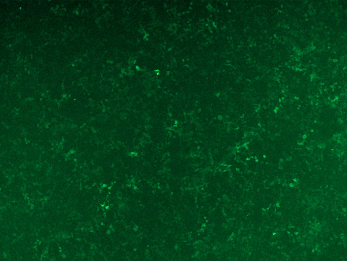 GFP signal was observed under microscope at 48 hours after transduction of TL308295A virus into HEK293 cells. TL308295A virus was prepared using lenti-shRNA TL308295A and TR30037 packaging kit.