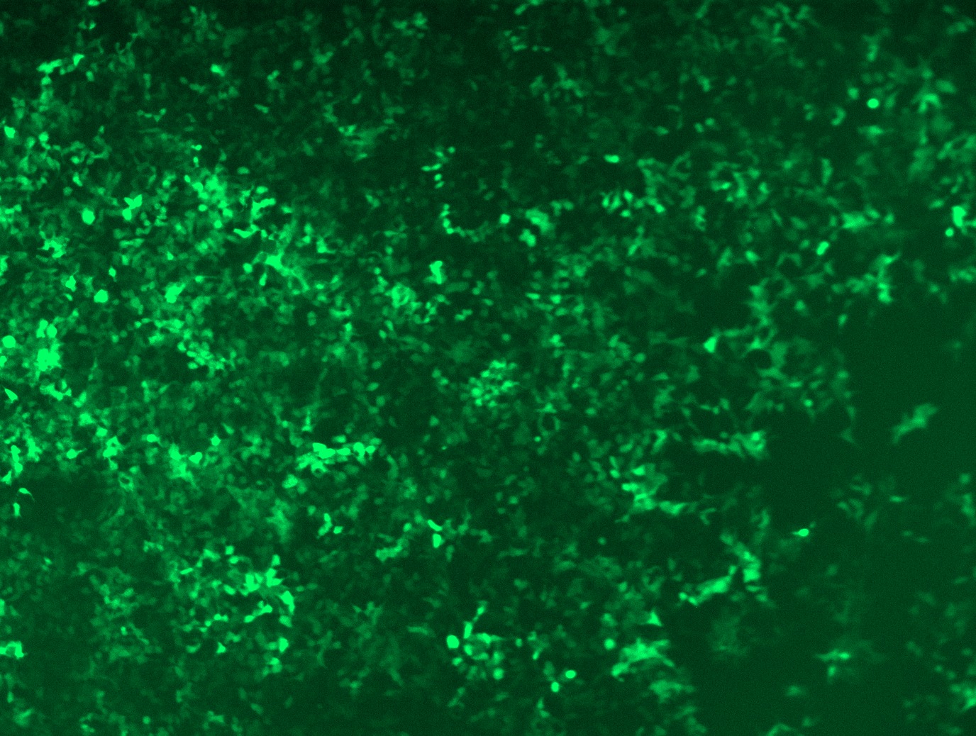 GFP signal was observed under microscope at 48 hours after transduction of TL308569A virus into HEK293 cells. TL308569A virus was prepared using lenti-shRNA TL308569A and TR30037 packaging kit.