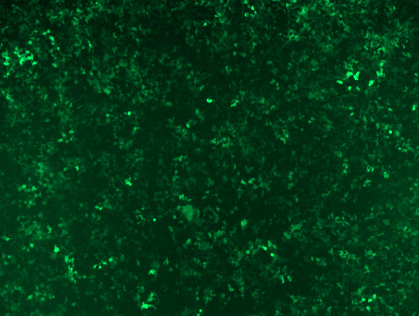 GFP signal was observed under microscope at 48 hours after transduction of TL315696A virus into HEK293 cells. TL315696A virus was prepared using lenti-shRNA TL315696A and TR30037 packaging kit.