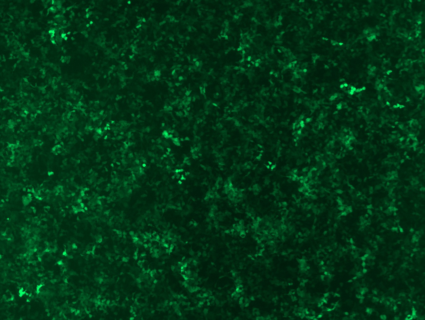 GFP signal was observed under microscope at 48 hours after transduction of TL316963A virus into HEK293 cells. TL316963A virus was prepared using lenti-shRNA TL316963A and TR30037 packaging kit.