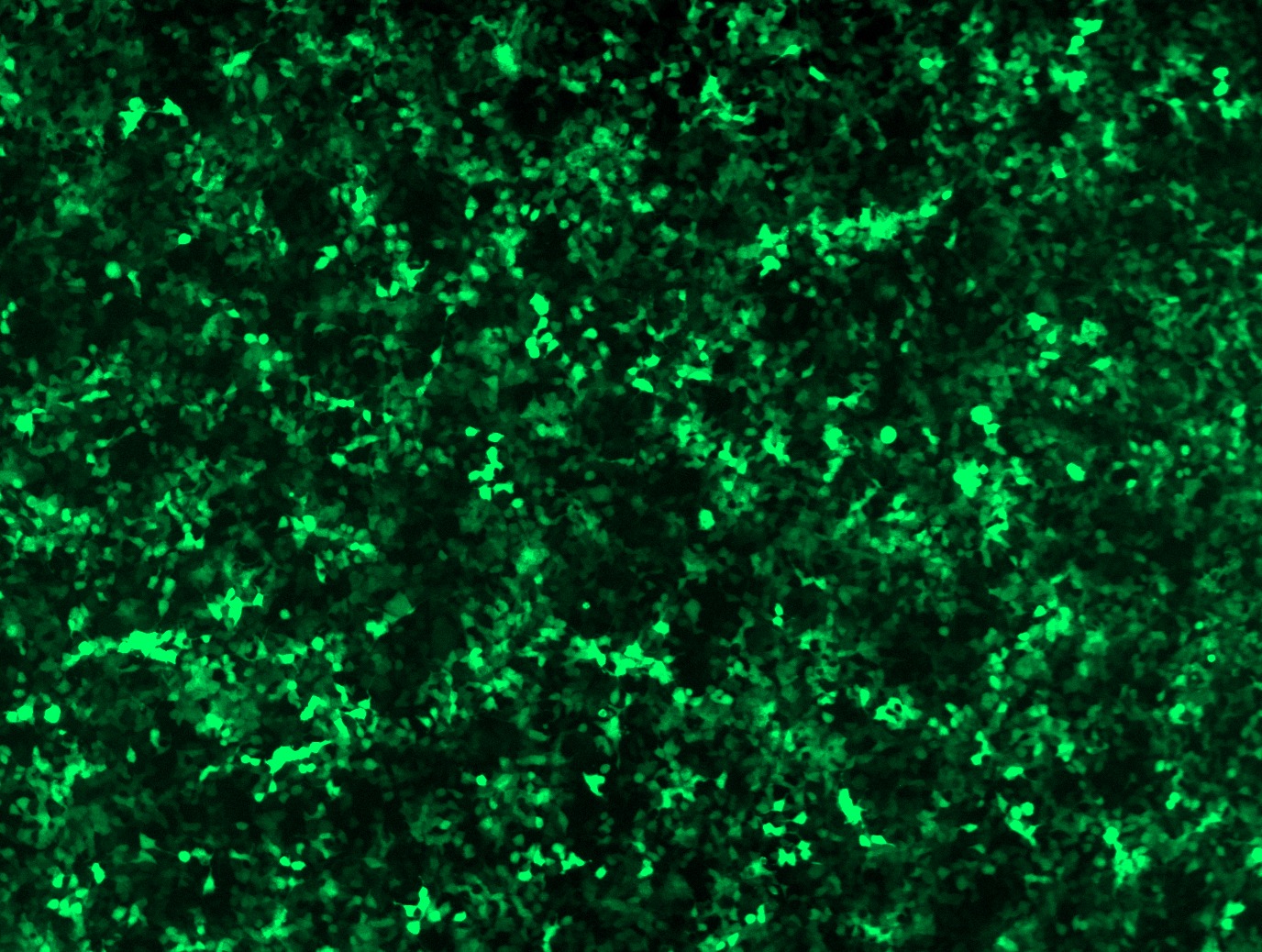 GFP signal was observed under microscope at 48 hours after transduction of TL500946A virus into HEK293 cells. TL500946A virus was prepared using lenti-shRNA TL500946A and TR30037 packaging kit.